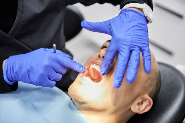 Best Emergency Tooth Extraction in Macclenny, FL